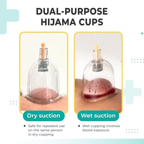 [100 Pack] Bulk Cupping Set for Massage Therapy - B1 B2 B3 B4 B5 B6 B7 U4 U5 - U4 (2.05 in) - Wholesale Professional Cupping Therapy Set, Cuppings Massage Kit, Physical Therapy Kit [No Pump Included] - Image 5