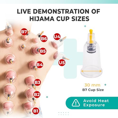 [100 Pack] Bulk Cupping Set for Massage Therapy - B1 B2 B3 B4 B5 B6 B7 U4 U5 - B7 (1.18 in) - Wholesale Professional Cupping Therapy Set, Cuppings Massage Kit, Physical Therapy Kit [No Pump Included] - Image 2