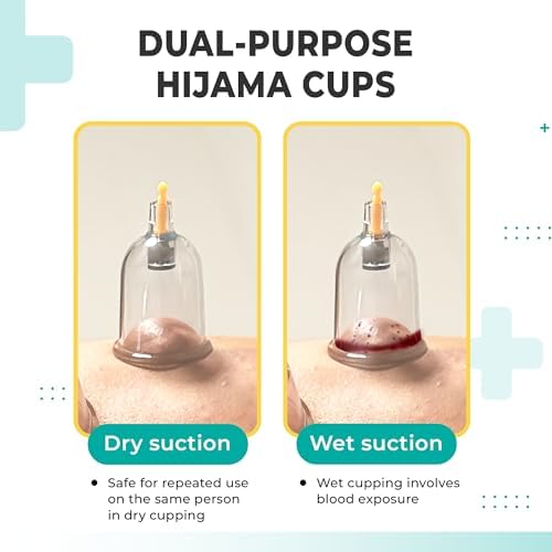 [100 Pack] Bulk Cupping Set for Massage Therapy - B1 B2 B3 B4 B5 B6 B7 U4 U5 - B7 (1.18 in) - Wholesale Professional Cupping Therapy Set, Cuppings Massage Kit, Physical Therapy Kit [No Pump Included] - Image 5