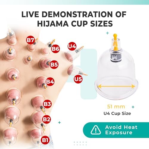 [100 Pack] Bulk Cupping Set for Massage Therapy - B1 B2 B3 B4 B5 B6 B7 U4 U5 - U4 (2.05 in) - Wholesale Professional Cupping Therapy Set, Cuppings Massage Kit, Physical Therapy Kit [No Pump Included] - Image 2